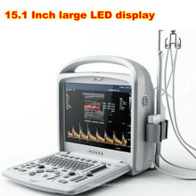 Top en China PT9600 portátil Color Doppler ultrasonido sistema de diagnóstico de
